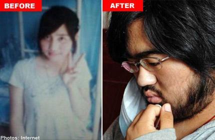 GARA2 TERAPI OBAT , WAJAH GADIS INI BERJENGGOT