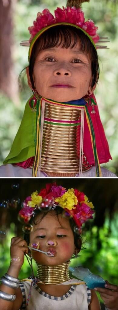 8 Modifikasi tubuh paling ekstreemm gan&quot;BUKTIKAN di Sini&quot;