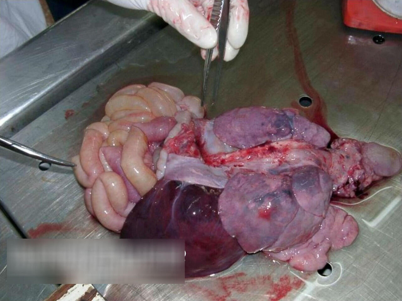 Baby boy autopsy