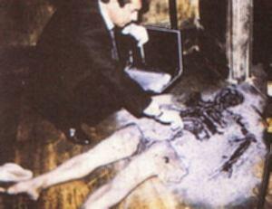 HATI-HATI GAN TUBUH KITA BISA MENGELUARKAN API