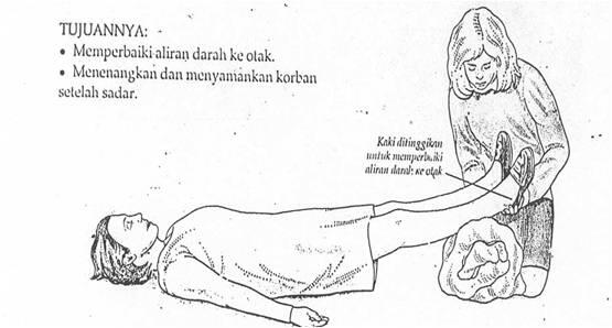 &#91;Share&#93; Cara mengatasi orang yang terkena Shock / Syok