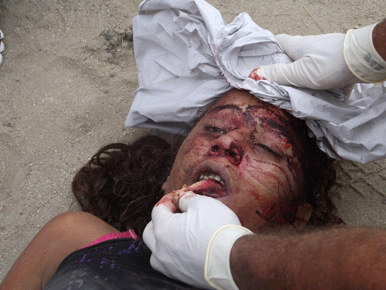 Hit With An Iron Bar