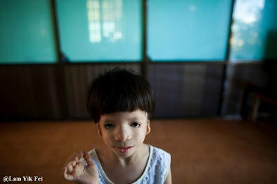 Foto Anak - Anak Korban Agent Orange Di Vietnam