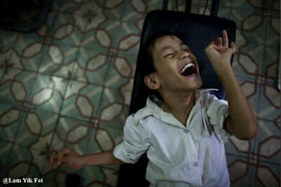 Foto Anak - Anak Korban Agent Orange Di Vietnam