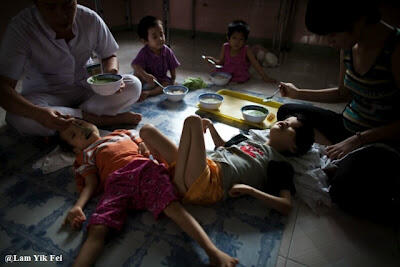 Foto Anak - Anak Korban Agent Orange Di Vietnam