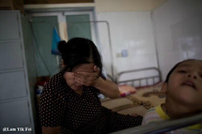 Foto Anak - Anak Korban Agent Orange Di Vietnam