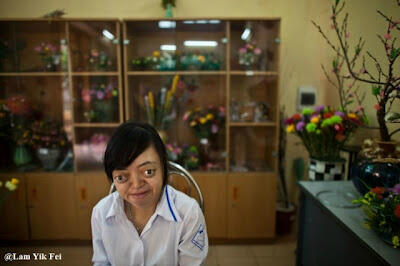 Foto Anak - Anak Korban Agent Orange Di Vietnam