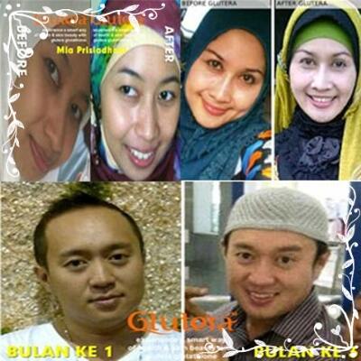 PELUANG BISNIS DASHYAT THN 2013 - GLUTERA GLUTATHIONE