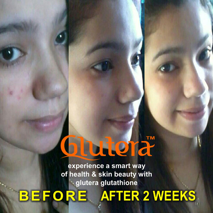 PELUANG BISNIS DASHYAT THN 2013 - GLUTERA GLUTATHIONE