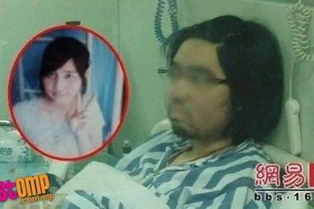 Wajah Si Cantik Jadi Berewokan Gara-gara Efek Samping Obat