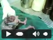 Manusia Berkepala Katak Gan !!! seremm