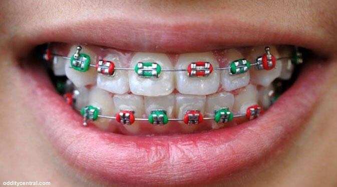 Bagi agan yang make BEHEL anu punya beberapa tantangan :D