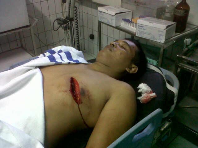 PERSPEKTIF BARU : PELAKU PENYERANGAN LP SLEMAN APARAT KEPOLISIAN? &#91;+PIC KORBAN DP&#93;