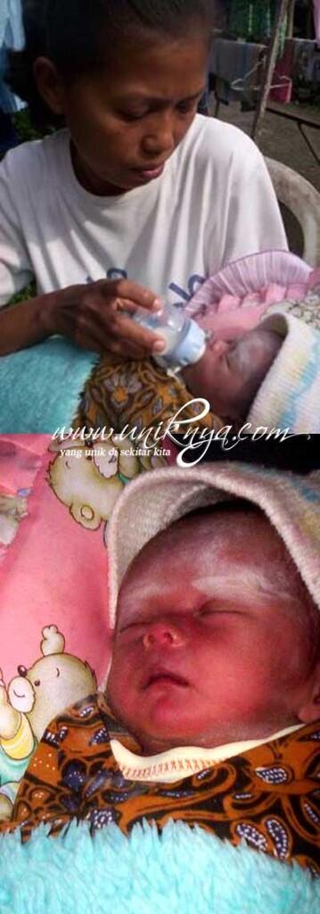 5 Kisah Melahirkan Tanpa Kehamilan