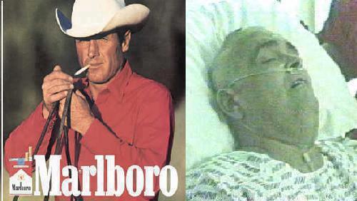 Bintang Iklan Rokok yang mengidap kanker paru2