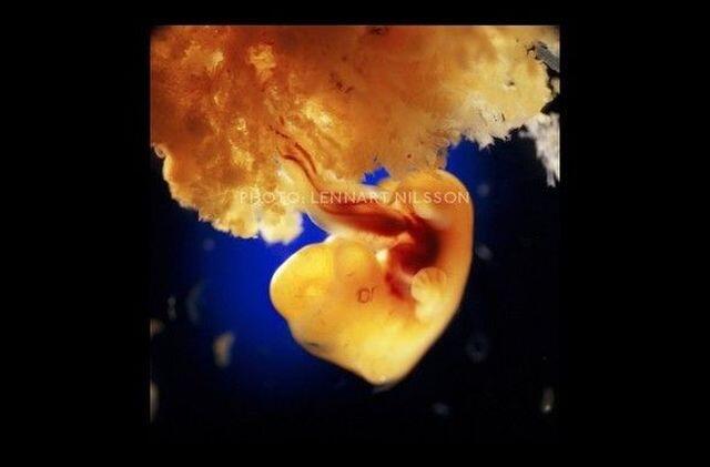 Foto-Foto Proses Pembentukan Fisik Manusia di Dalam Rahim Ibu