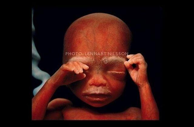 Foto-Foto Proses Pembentukan Fisik Manusia di Dalam Rahim Ibu