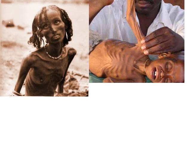 Setiap Hari di Seluruh Dunia 25.000 Orang Meninggal karena Kelaparan &amp; Kemiskinan