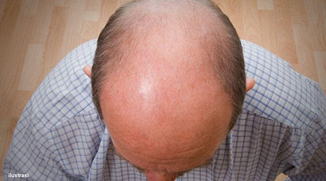 Botak pada Pria Tanda Kesuksesan, Dominasi dan Kekayaan