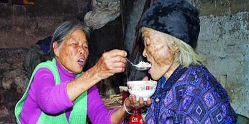Peng Xiuhua, Nenek 101 Tahun Hidup Kembali Dalam Peti Mati