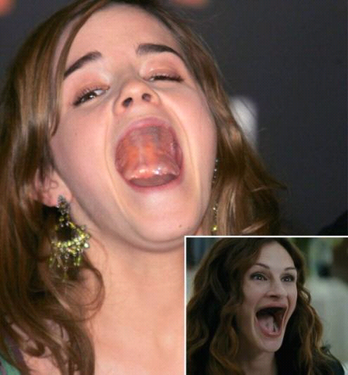 Bagaimana Jadinya Kalo Artis Gak Punya Gigi