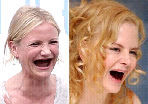 Bagaimana Jadinya Kalo Artis Gak Punya Gigi