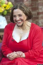 kisah nyata seorang wanita berjenggot