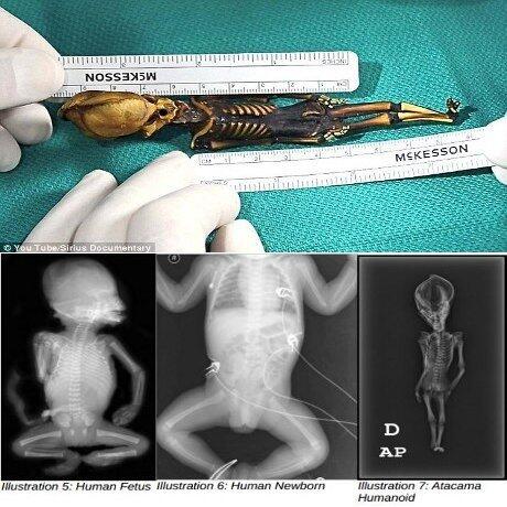 Misteri 'Alien' yang Ditemukan di Chili 10 Tahun Lalu Terkuak