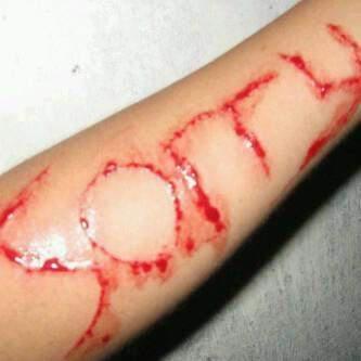 Ababil lukai Tangan Pakai Silet