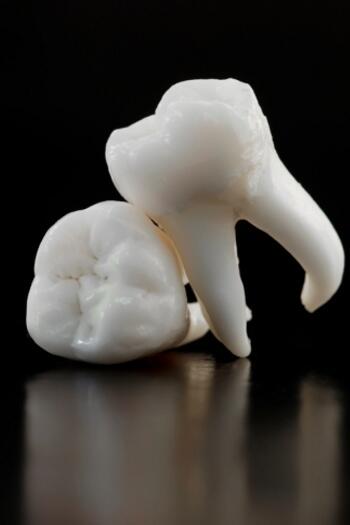 5 Pengobatan Sakit Jiwa Paling Unik Di Dunia