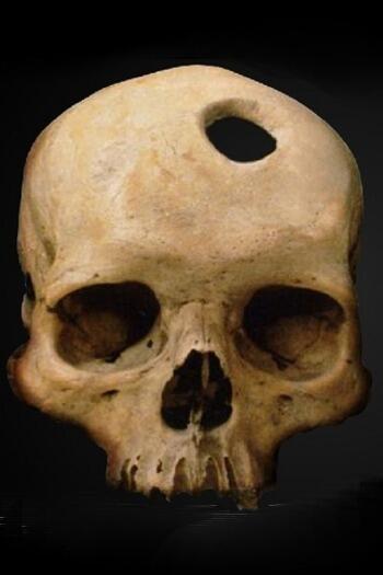 5 Pengobatan Sakit Jiwa Paling Unik Di Dunia