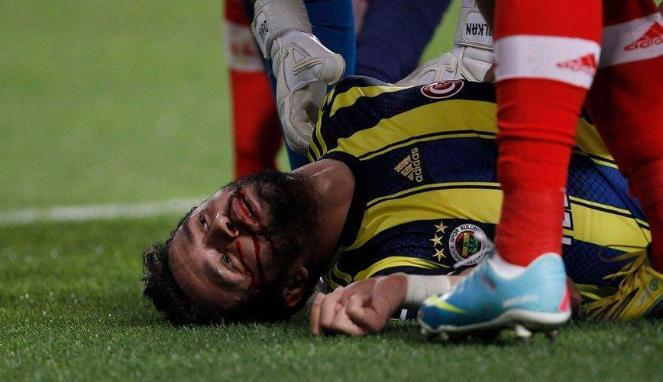 &#91;Tragis Gan&#93; Gokhan Gonul Bek Fenerbahce yang &quot;KO&quot; Usai Wajahnya Tertendang Lawan