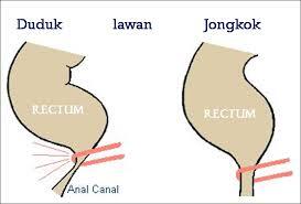 GAN SIS..ana baru tau pipis n BAB jongkok tuh bgus lho....