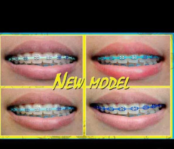 Terjual PASANG BEHEL PERMANENT KHUSUS BEKASI  KASKUS