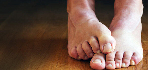 [WOW] Orang Impoten Bisa Dilihat dari Kakinya