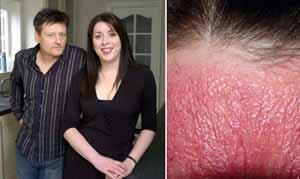 Manusia Unik dan Aneh