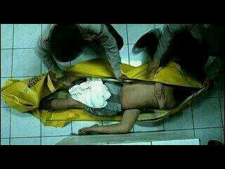 Fenomena Kelamin Gancet Di Lihat Dari Kacamata Medis.......