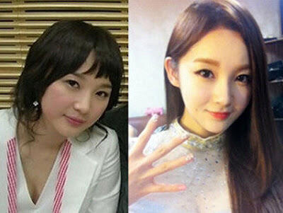 10 Foto Masa Lalu Seleb Korea Yang Berubah Drastis