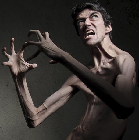 Javier Botet : Aktor Horor Pengidap Sindrom Marfan