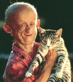 Mengenal Penyakit Progeria atau Penuaan Dini
