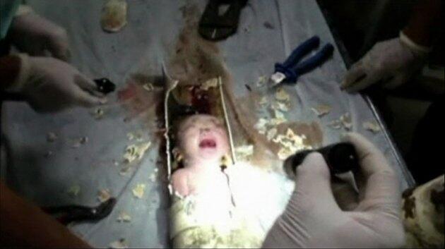 FOTO-FOTO BAYI DISELAMATKAN DALAM PIPA TOILET.