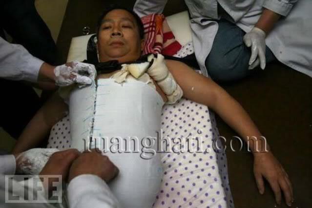 PRIA DENGAN TUBUH SEPARUH,TAPI MASIH HIDUP!!!!!!!