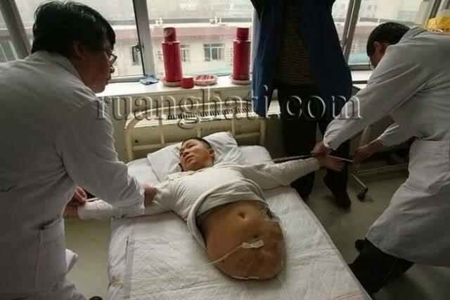 PRIA DENGAN TUBUH SEPARUH,TAPI MASIH HIDUP!!!!!!!