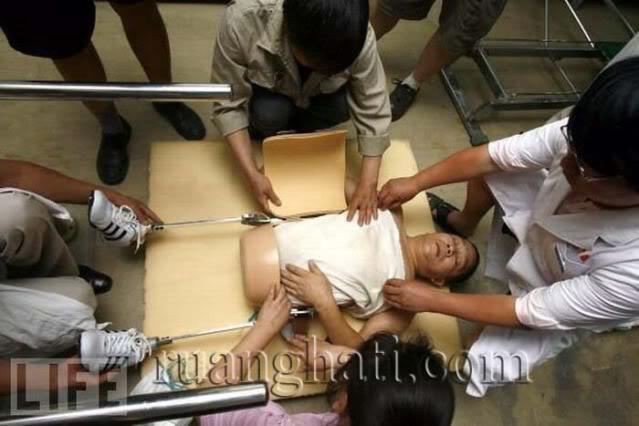 PRIA DENGAN TUBUH SEPARUH,TAPI MASIH HIDUP!!!!!!!