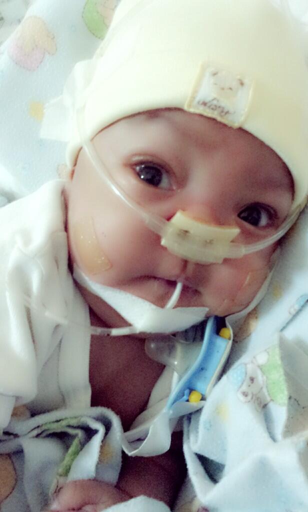 BABY BIYAN &quot;Si kecil yang ingin bertahan hidup&quot;