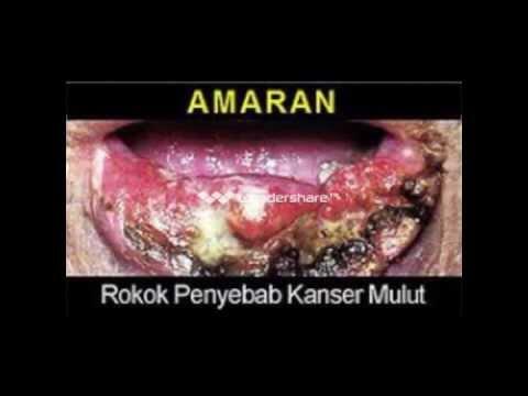 Masuk GAN yang &#91; MEROKOK &#93;