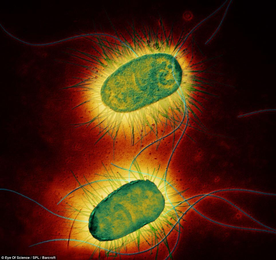 virus dan bakteri paling mematikan di dunia