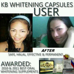 (^▿') -▹ CELL ROLLER-ALAT PENGHANCUR LEMAK,PENGHILANG SELULIT PERUT,PAHA,LENGAN,BETIS