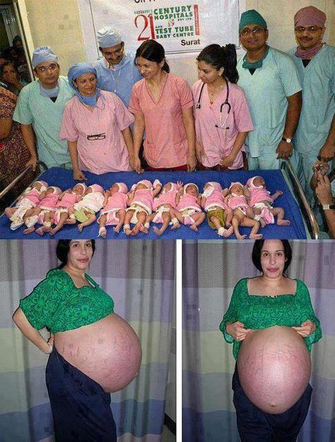 Luar Biasa! Wanita India melahirkan 11 anak sekaligus