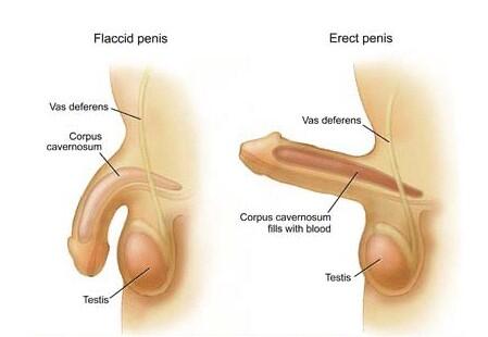 Buset...Diduga malpraktik, Mr P pria ini 'berdiri' selama 8 bulan